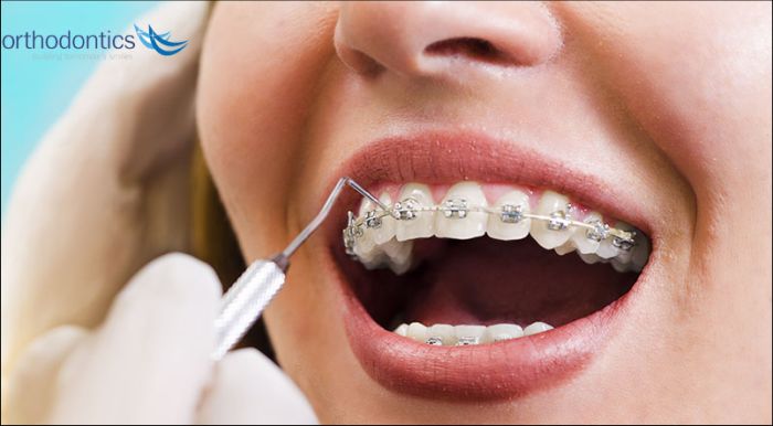 Best Colleges for Orthodontists in the U.S.